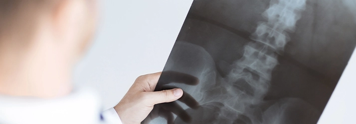 A person holding a X-ray.